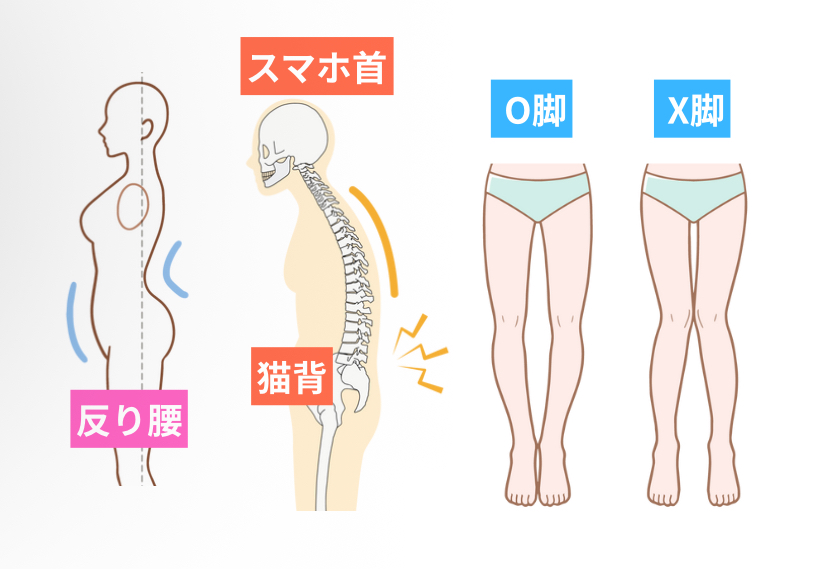 違い